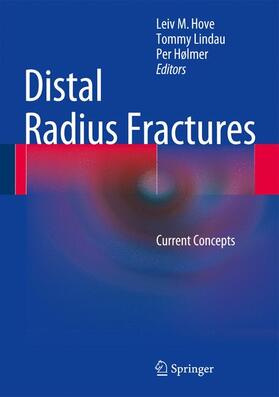 Hove / Lindau / Hølmer |  Distal Radius Fractures | Buch |  Sack Fachmedien