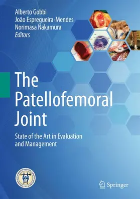 Gobbi / Espregueira-Mendes / Nakamura |  The Patellofemoral Joint | Buch |  Sack Fachmedien