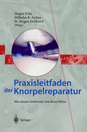 Fritz / Aicher / Eichhorn |  Praxisleitfaden der Knorpelreparatur | eBook | Sack Fachmedien