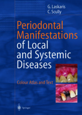 Laskaris / Scully |  Periodontal Manifestations of Local and Systemic Diseases | eBook | Sack Fachmedien