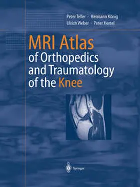 Teller / König / Weber |  MRI Atlas of Orthopedics and Traumatology of the Knee | eBook | Sack Fachmedien