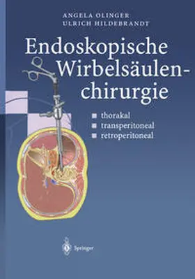 Olinger / Hildebrandt |  Endoskopische Wirbelsäulenchirurgie | eBook | Sack Fachmedien