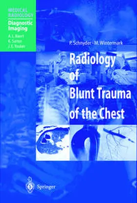 Schnyder / Wintermark |  Radiology of Blunt Trauma of the Chest | eBook | Sack Fachmedien