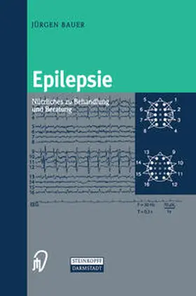 Bauer |  Epilepsie | eBook | Sack Fachmedien