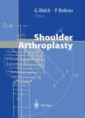 Walch / Boileau |  Shoulder Arthroplasty | eBook | Sack Fachmedien