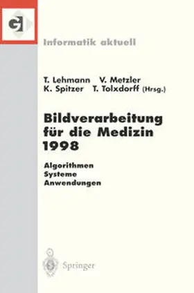 Lehmann / Metzler / Spitzer |  Bildverarbeitung für die Medizin 1998 | eBook | Sack Fachmedien