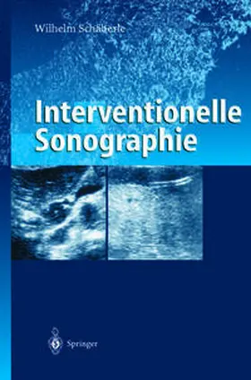 Schäberle |  Interventionelle Sonographie | eBook | Sack Fachmedien