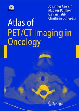 Czernin / Dahlbom / Schiepers |  Atlas of PET/CT Imaging in Oncology | Buch |  Sack Fachmedien