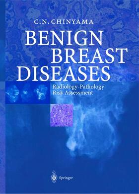 Chinyama |  Benign Breast Diseases | Buch |  Sack Fachmedien