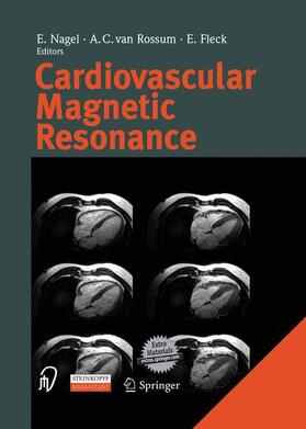 Nagel / Fleck / Rossum |  Cardiovascular Magnetic Resonance | Buch |  Sack Fachmedien