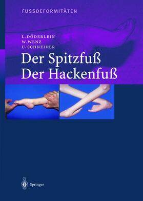 Döderlein / Schneider / Wenz |  Fussdeformitäten | Buch |  Sack Fachmedien