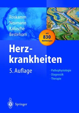 Roskamm / Neumann / Kalusche |  Herzkrankheiten | Buch |  Sack Fachmedien