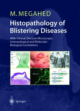 Megahed |  Histopathology of Blistering Diseases | Buch |  Sack Fachmedien