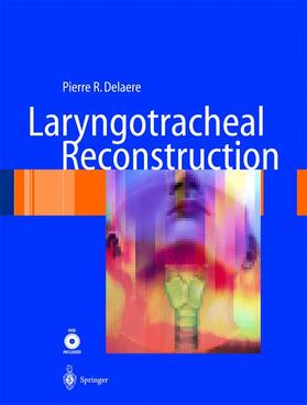 Delaere |  Laryngotracheal Reconstruction | Buch |  Sack Fachmedien