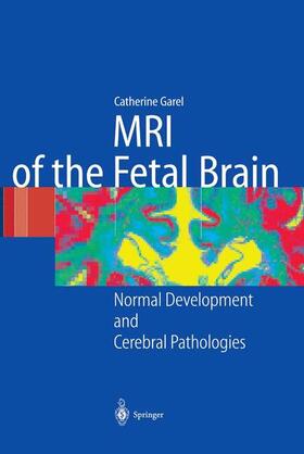 Garel |  MRI of the Fetal Brain | Buch |  Sack Fachmedien