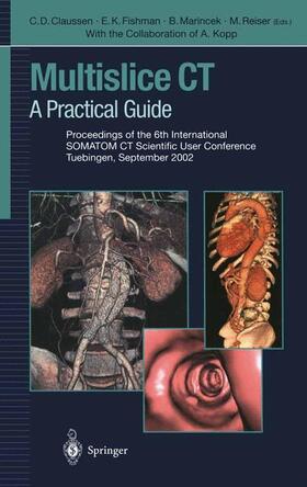 Claussen / Fishman / Reiser |  Multislice CT | Buch |  Sack Fachmedien