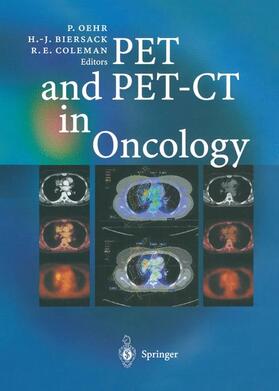 Oehr / Coleman / Biersack |  PET and PET-CT in Oncology | Buch |  Sack Fachmedien
