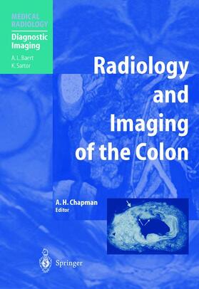 Chapman | Radiology and Imaging of the Colon | Buch | 978-3-642-62314-1 | sack.de