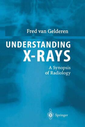 van Gelderen |  Understanding X-Rays | Buch |  Sack Fachmedien