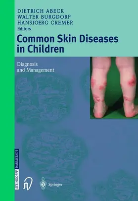 Abeck / Cremer / Burgdorf |  Common Skin Diseases in Children | Buch |  Sack Fachmedien