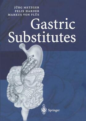 Metzger / Flüe / Harder |  Gastric Substitutes | Buch |  Sack Fachmedien