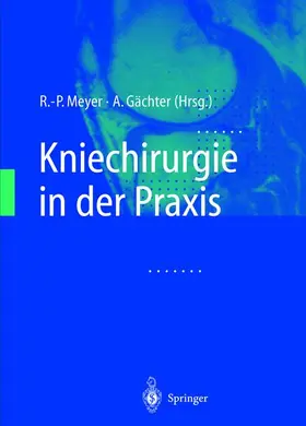 Gächter / Meyer |  Kniechirurgie in der Praxis | Buch |  Sack Fachmedien