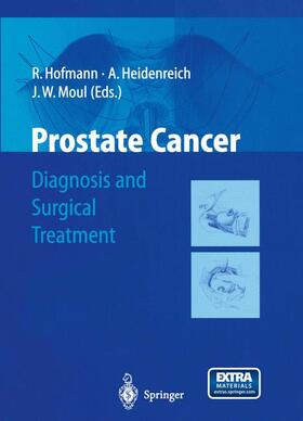 Hofmann / Moul / Heidenreich |  Prostate Cancer | Buch |  Sack Fachmedien