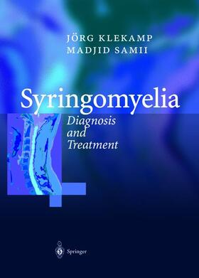 Klekamp / Samii |  Syringomyelia | Buch |  Sack Fachmedien