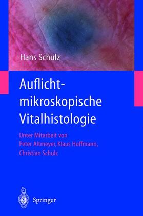 Schulz |  Auflichtmikroskopische Vitalhistologie | Buch |  Sack Fachmedien
