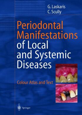 Laskaris / Scully |  Periodontal Manifestations of Local and Systemic Diseases | Buch |  Sack Fachmedien