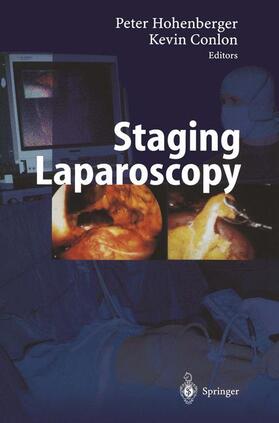 Conlon / Hohenberger |  Staging Laparoscopy | Buch |  Sack Fachmedien