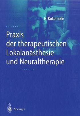 Kokemohr |  Praxis der therapeutischen Lokalanästhesie und Neuraltherapie | Buch |  Sack Fachmedien