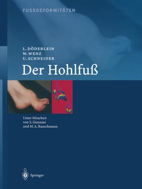 Döderlein / Wenz / Schneider |  Fussdeformitäten | Buch |  Sack Fachmedien