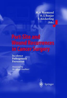 Reymond / Köckerling / Bonjer |  Port-Site and Wound Recurrences in Cancer Surgery | Buch |  Sack Fachmedien