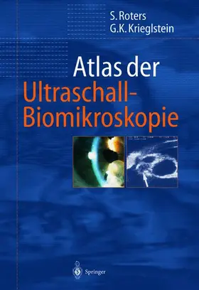 Krieglstein / Roters |  Atlas der Ultraschall-Biomikroskopie | Buch |  Sack Fachmedien