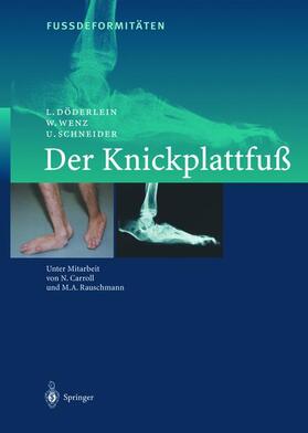 Wenz / Schneider / Döderlein |  FussdeformitÄten | Buch |  Sack Fachmedien