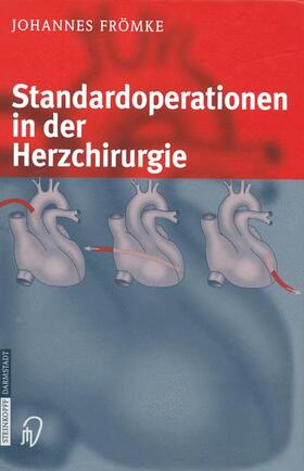 Frömke |  Standardoperationen in der Herzchirurgie | Buch |  Sack Fachmedien