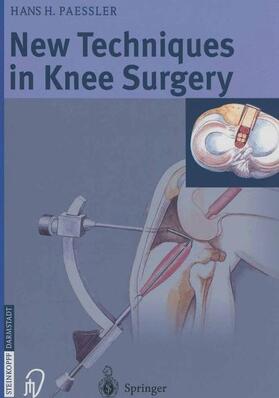 Paessler |  New Techniques in Knee Surgery | Buch |  Sack Fachmedien