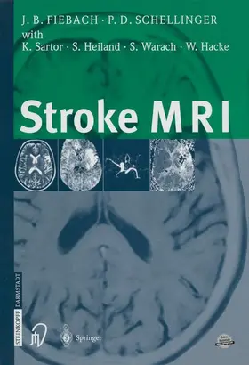 Schellinger / Fiebach |  Stroke MRI | Buch |  Sack Fachmedien