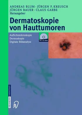 Blum / Garbe / Kreusch |  Dermatoskopie von Hauttumoren | Buch |  Sack Fachmedien