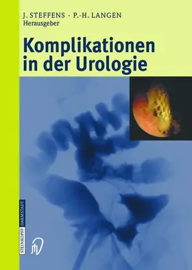 Steffens / Langen |  Komplikationen in der Urologie | Buch |  Sack Fachmedien