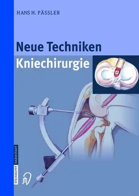 Pässler |  Neue Techniken Kniechirurgie | Buch |  Sack Fachmedien