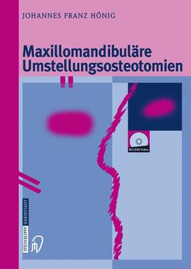 Hönig |  Maxillomandibuläre Umstellungsosteotomien | Buch |  Sack Fachmedien