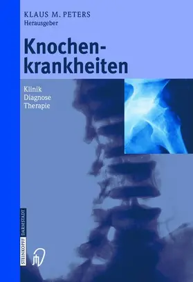 Peters |  Knochenkrankheiten | Buch |  Sack Fachmedien