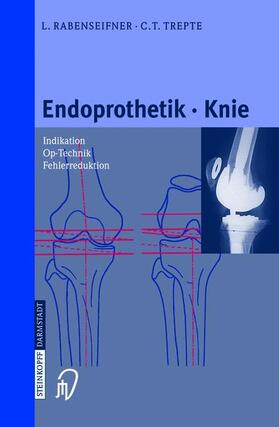 Trepte / Rabenseifner |  Endoprothetik Knie | Buch |  Sack Fachmedien