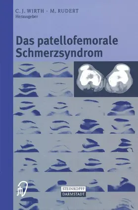 Wirth / Rudert |  Das patellofemorale Schmerzsyndrom | Buch |  Sack Fachmedien