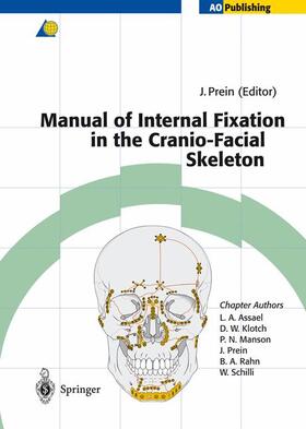 Prein |  Manual of Internal Fixation in the Cranio-Facial Skeleton | Buch |  Sack Fachmedien