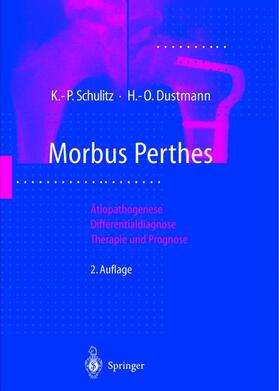 Dustmann / Schulitz |  Morbus Perthes | Buch |  Sack Fachmedien