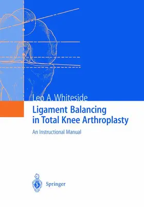 Whiteside |  Ligament Balancing in Total Knee Arthroplasty | Buch |  Sack Fachmedien