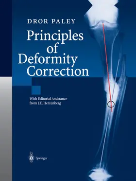 Paley |  Principles of Deformity Correction | Buch |  Sack Fachmedien